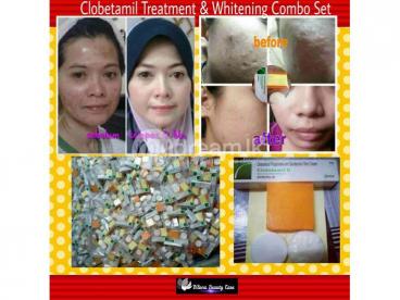 Clobetamil G pimple and pigmentation cream.