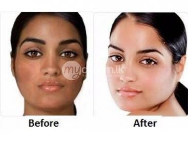 SKIN BLEMISHES CLEARING CREAM +27783431987 in Zambia